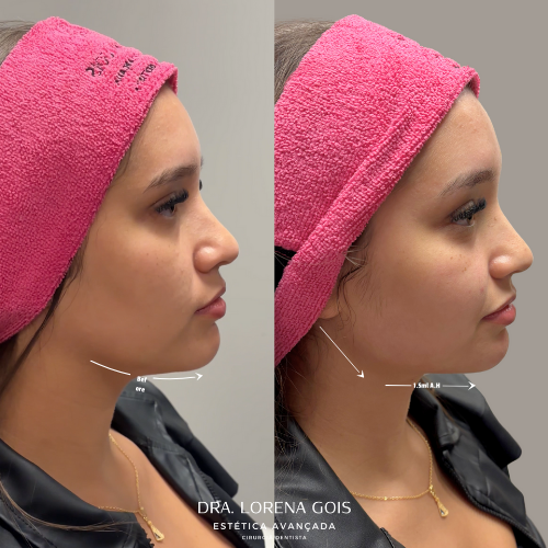 lorena (500 x 500 px) (1)