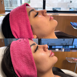 lorena (500 x 500 px) (250 x 250 px)