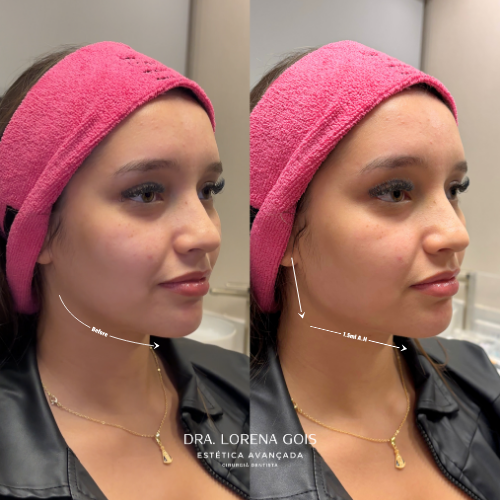 lorena (500 x 500 px)